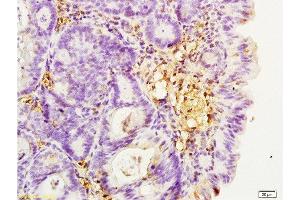 Formalin-fixed and paraffin embedded rat colitis tissue labeled with Anti-Integrin β2/CD18/LFA-1 Polyclonal Antibody, Unconjugated  at 1:200, followed by conjugation to the secondary antibody and DAB staining (Integrin beta 2 Antikörper  (AA 701-770))