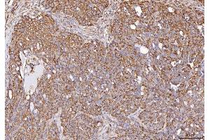 IHC analysis of Calmegin/CLGN using anti-Calmegin/CLGN antibody (ABIN7601481). (Calmegin Antikörper  (AA 36-610))