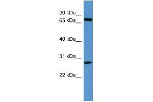 WB Suggested Anti-BBS10  Antibody Titration: 0. (BBS10 Antikörper  (C-Term))