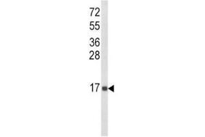 Western Blotting (WB) image for anti-Interleukin 8 (IL8) (AA 72-99) antibody (ABIN3031487)
