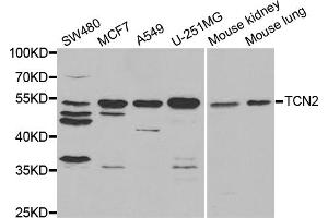Western blot analysis of extracts of various cell lines, using TCN2 antibody. (TCN2 Antikörper)
