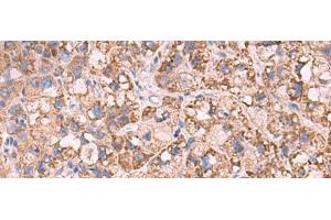 Immunohistochemistry (Paraffin-embedded Sections) (IHC (p)) image for anti-Potassium Intermediate/small Conductance Calcium-Activated Channel, Subfamily N, Member 1 (KCNN1) antibody (ABIN7251631)