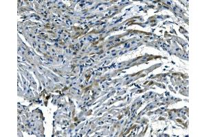 IHC analysis of NDUFB5 using anti-NDUFB5 antibody (ABIN7601297).