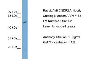 WB Suggested Anti-CNDP2  Antibody Titration: 0. (CNDP2 Antikörper  (Middle Region))
