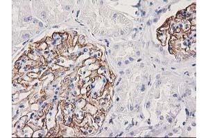 Immunohistochemical staining of paraffin-embedded Human Kidney tissue using anti-PDLIM2 mouse monoclonal antibody. (PDLIM2 Antikörper)