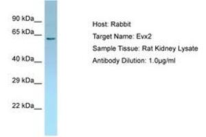 Image no. 1 for anti-Homeobox even-skipped homolog protein 2 (EVX2) (AA 51-100) antibody (ABIN6749824) (EVX2 Antikörper  (AA 51-100))