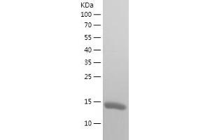 TXNDC17 Protein (AA 2-123) (His tag)