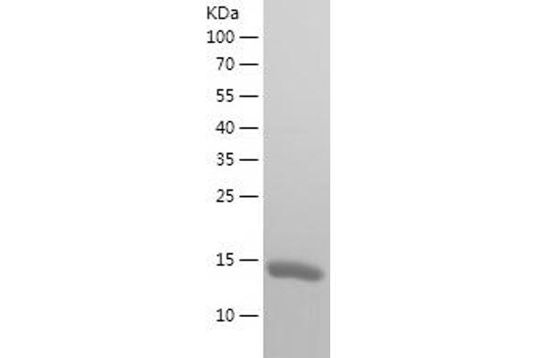 TXNDC17 Protein (AA 2-123) (His tag)