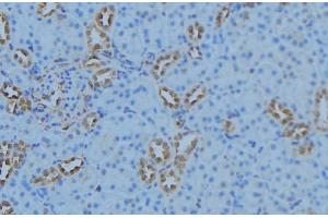 ABIN6279098 at 1/100 staining Mouse kidney tissue by IHC-P. (AGXT2 Antikörper  (Internal Region))