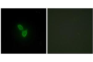 Immunofluorescence analysis of HepG2 cells, using PARD3 antibody. (PARD3 Antikörper  (C-Term))