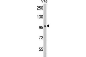 Western blot analysis of KPNB1 Antibody (N-term) in Y79 cell line lysates (35ug/lane).