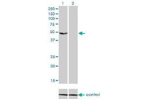 Western blot analysis of C9orf98 over-expressed 293 cell line, cotransfected with C9orf98 Validated Chimera RNAi (Lane 2) or non-transfected control (Lane 1).