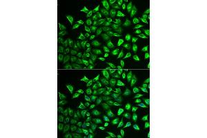 Immunofluorescence analysis of U2OS cells using MMRN1 antibody (ABIN6129053, ABIN6143926, ABIN6143927 and ABIN6222357). (Multimerin 1 Antikörper  (AA 949-1228))