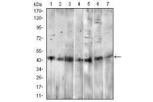 Western blot analysis using CD14 mouse mAb against HepG2 (1), A549 (2), HL60 (3), RAW264.