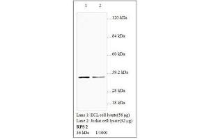 Image no. 1 for anti-Ribosomal Protein S2 (RPS2) antibody (ABIN791359) (RPS2 Antikörper)