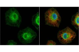 Immunofluorescence (IF) image for anti-Induced Myeloid Leukemia Cell Differentiation Protein Mcl-1 (MCL1) (Center) antibody (ABIN2855261)