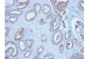Formalin-fixed, paraffin-embedded human Prostate stained with Pan-Cytokeratin Mouse Monoclonal Antibody (PCK/3150). (KRT Antikörper)