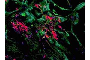 Immunostaining of mixed neuron/glial cultures showing specific cytoplasmic labeling of dendrites and perikarya of neuronal cells in red with anti-MAP2C/D and astrocyte and fibroblast labeling (green) with anti-vimentin ( ABIN361371). (MAP2 Antikörper)