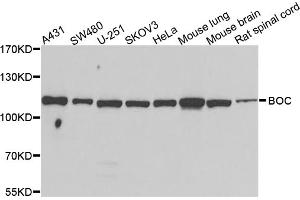 Western blot analysis of extracts of various cell lines, using BOC antibody. (BOC Antikörper)
