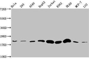 Western Blot Positive WB detected in: Hela whole cell lysate, 293 whole cell lysate, A549 whole cell lysate, HepG2 whole cell lysate, Jurkat whole cell lysate, K562 whole cell lysate, HL60 whole cell lysate, MCF-7 whole cell lysate, LO2 whole cell lysate All lanes: HIST1H1E antibody at 1:500 Secondary Goat polyclonal to rabbit IgG at 1/40000 dilution Predicted band size: 22 kDa Observed band size: 22 kDa (HIST1H1E Antikörper)