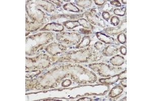 Immunohistochemistry (IHC) image for anti-Galactosidase, beta 1 (GLB1) (AA 1-270) antibody (ABIN3015643)