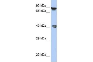 Western Blot showing ZNF429 antibody used at a concentration of 1-2 ug/ml to detect its target protein. (ZNF429 Antikörper  (N-Term))