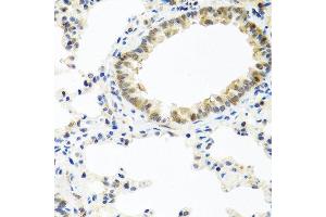 Immunohistochemistry of paraffin-embedded rat lung using BMP5 antibody at dilution of 1:100 (40x lens). (BMP5 Antikörper)