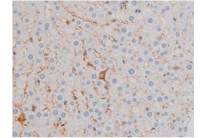 ABIN6256119 and ABIN6267471 at 1/200 staining Rat liver tissue sections by IHC-P. (AKT1 Antikörper  (pSer124))