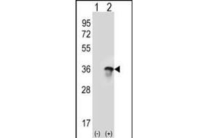 Western blot analysis of U2AF1 (arrow) using rabbit polyclonal U2AF1 Antibody (Center ) (ABIN389305 and ABIN2839425). (U2AF1 Antikörper  (AA 99-125))