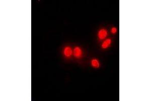 Immunofluorescent analysis of DNAJB6 staining in MCF7 cells. (DNAJB6 Antikörper)