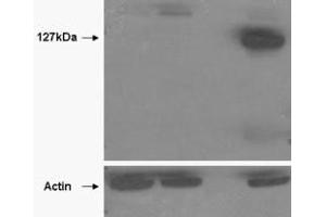 Image no. 1 for anti-Tankyrase, TRF1-Interacting Ankyrin-Related ADP-Ribose Polymerase 2 (TNKS2) (AA 800-900) antibody (ABIN401534) (TNKS2 Antikörper  (AA 800-900))