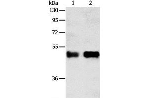 Western Blot analysis of Human liver cancer tissue and A549 cell using SERPINA5 Polyclonal Antibody at dilution of 1:750 (SERPINA5 Antikörper)