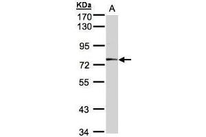 WB Image Sample(30 ug whole cell lysate) A:A431, 7. (MEP1A Antikörper)