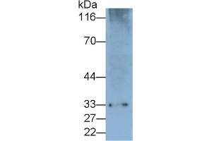 Detection of PD1 in Rat Spleen lysate using Polyclonal Antibody to Programmed Cell Death Protein 1 (PD1) (PD-1 Antikörper  (AA 41-132))