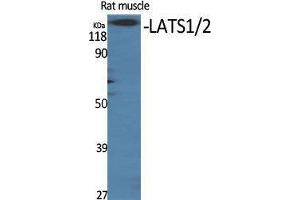 Western Blotting (WB) image for anti-LATS1,2 (Ser116) antibody (ABIN3180713) (LATS1,2 (Ser116) Antikörper)