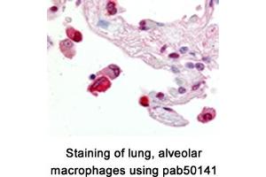 Image no. 1 for anti-ATP-Binding Cassette, Sub-Family G (WHITE), Member 1 (ABCG1) (AA 300-400), (Internal Region) antibody (ABIN363450)