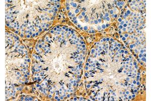 ABIN6263173 and ABIN6273135 at 1/100 staining Mouse testis tissue by IHC-P. (MDH1 Antikörper  (C-Term))