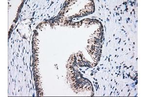 Immunohistochemical staining of paraffin-embedded Human liver tissue using anti-MOBKL1A mouse monoclonal antibody. (MOBKL1A Antikörper)