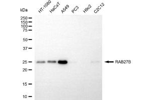 Western blotting analysis using RAB27B antibody (ABIN7800095).