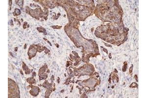 Immunohistochemistry (IHC) image for anti-Keratin 17 (KRT17) (C-Term) antibody (ABIN870567) (KRT17 Antikörper  (C-Term))