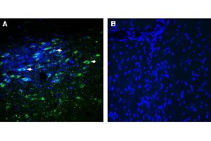 Expression of Glycine Receptor alpha 3 in rat substantia nigra pars compacta (SNC). (GLRA3 Antikörper  (AA 355-368))