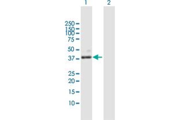 PLA2G15 anticorps  (AA 1-412)