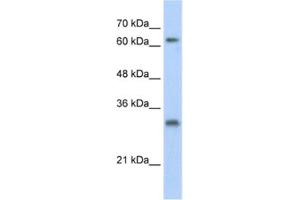 Western Blotting (WB) image for anti-Ubiquitin Specific Peptidase 39 (USP39) antibody (ABIN2461797) (USP39 Antikörper)