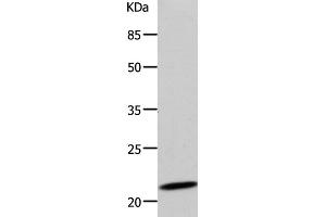 Western Blot analysis of 293T cell using DUT Polyclonal Antibody at dilution of 1:500 (Deoxyuridine Triphosphatase (DUT) Antikörper)