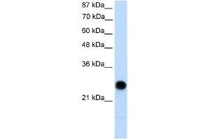 WB Suggested Anti-VDAC2 Antibody Titration:  0.