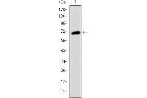 Western blot analysis using KIT mAb against human KIT (AA: 805-976) recombinant protein.