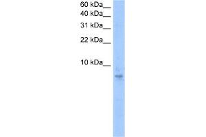 WB Suggested Anti-SEPT6(septin 6) Antibody Titration:  0. (Septin 6 Antikörper  (N-Term))