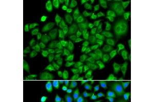 Immunofluorescence analysis of A549 cells using NAA50 Polyclonal Antibody (NAA50 Antikörper)