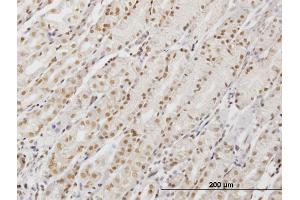 Immunoperoxidase of monoclonal antibody to DDX54 on formalin-fixed paraffin-embedded human stomach. (DDX54 Antikörper  (AA 778-881))