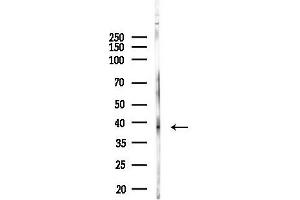 anti-Abhydrolase Domain Containing 5 (ABHD5) (Internal Region) antibody